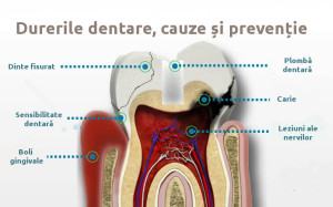 Causes-of-toothache