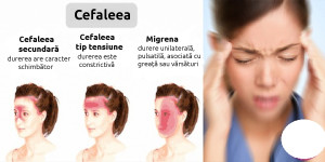 cefaleea